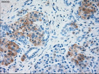 Anti-alpha 1 Antitrypsin antibody [15H10] used in IHC (Paraffin sections) (IHC-P). GTX83665