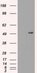 Anti-alpha 1 Antitrypsin antibody [15H10] used in Western Blot (WB). GTX83665