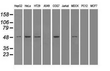 Anti-alpha 1 Antitrypsin antibody [15H10] used in Western Blot (WB). GTX83665