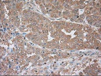 Anti-alpha 1 Antitrypsin antibody [9A1] used in IHC (Paraffin sections) (IHC-P). GTX83666