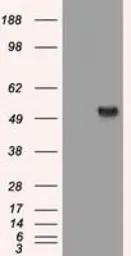 Anti-alpha 1 Antitrypsin antibody [9A1] used in Western Blot (WB). GTX83666