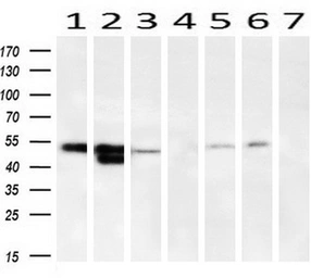 Anti-alpha 1 Antitrypsin antibody [9A1] used in Western Blot (WB). GTX83666