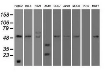 Anti-alpha 1 Antitrypsin antibody [9A1] used in Western Blot (WB). GTX83666
