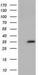 Anti-SDR9C7 antibody [7E11] used in Western Blot (WB). GTX83669