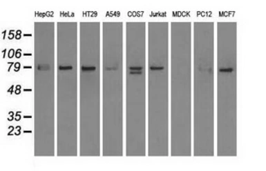 Anti-SCYL3 antibody [4F10] used in Western Blot (WB). GTX83676