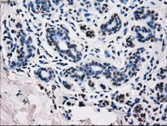 Anti-RPA32 antibody [8B3] used in IHC (Paraffin sections) (IHC-P). GTX83688