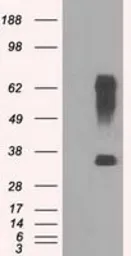 Anti-RNF144B antibody [11F4] used in Western Blot (WB). GTX83705