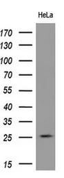 Anti-RND1 antibody [4F12] used in Western Blot (WB). GTX83709