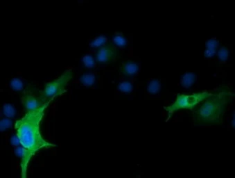 Anti-RND1 antibody [4F12] used in Immunocytochemistry/ Immunofluorescence (ICC/IF). GTX83709
