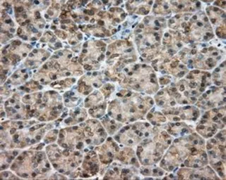 Anti-RDH11 antibody [1B4] used in IHC (Paraffin sections) (IHC-P). GTX83716