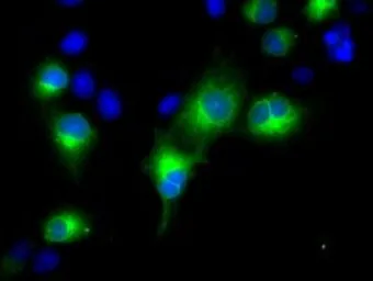 Anti-RDH11 antibody [1B4] used in Immunocytochemistry/ Immunofluorescence (ICC/IF). GTX83716