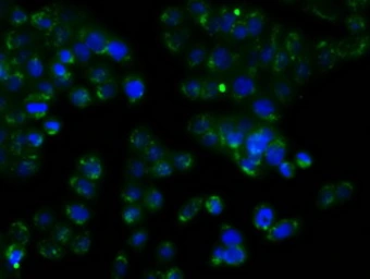 Anti-RDH11 antibody [1B4] used in Immunocytochemistry/ Immunofluorescence (ICC/IF). GTX83716