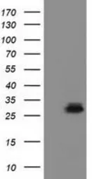 Anti-RASD2 antibody [1G1] used in Western Blot (WB). GTX83722