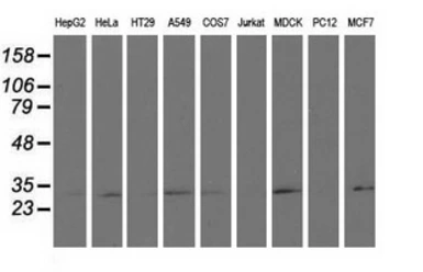 Anti-RASD2 antibody [1G1] used in Western Blot (WB). GTX83722