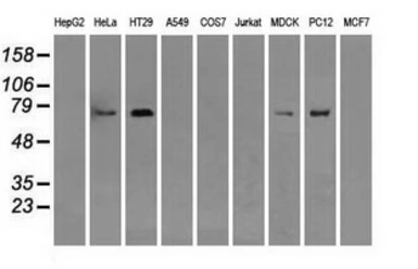 Anti-RALBP1 antibody [11B2] used in Western Blot (WB). GTX83728