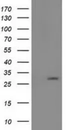 Anti-PYCRL antibody [2E10] used in Western Blot (WB). GTX83750