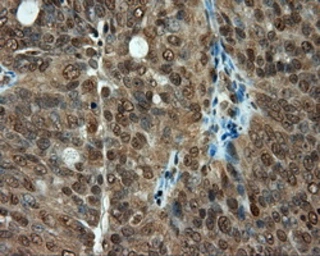Anti-PSMC3 antibody [1C10] used in IHC (Paraffin sections) (IHC-P). GTX83784