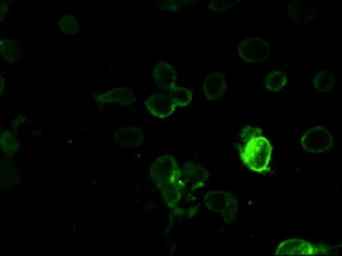 Anti-PROM2 antibody [3D12] used in Immunocytochemistry/ Immunofluorescence (ICC/IF). GTX83794