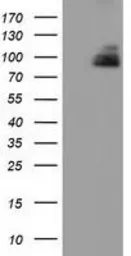 Anti-PKD2 antibody [3B12] used in Western Blot (WB). GTX83819
