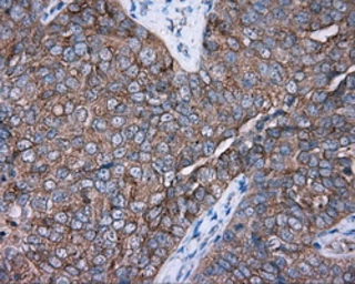 Anti-PKA R2 antibody [1B4] used in IHC (Paraffin sections) (IHC-P). GTX83826