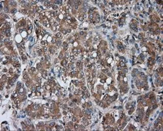 Anti-PKA R2 antibody [1B4] used in IHC (Paraffin sections) (IHC-P). GTX83826