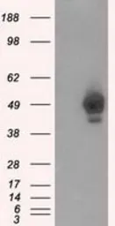 Anti-PKA R2 antibody [1B4] used in Western Blot (WB). GTX83826
