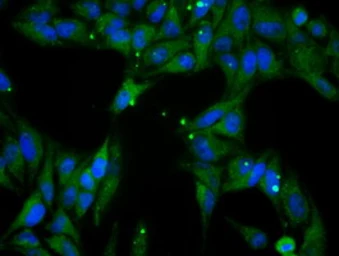 Anti-PPP5C antibody [3G1] used in Immunocytochemistry/ Immunofluorescence (ICC/IF). GTX83836