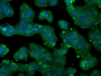 Anti-POR antibody [6C4] used in Immunocytochemistry/ Immunofluorescence (ICC/IF). GTX83854
