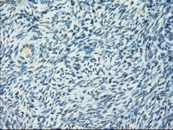 Anti-POR antibody [1B11] used in IHC (Paraffin sections) (IHC-P). GTX83858