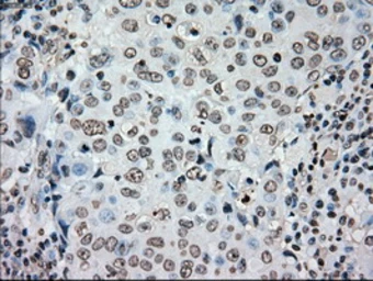 Anti-PLK1 antibody [1D4] used in IHC (Paraffin sections) (IHC-P). GTX83865