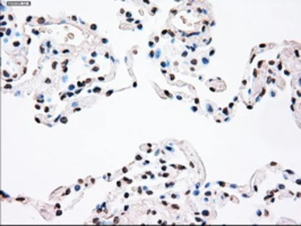 Anti-PLK1 antibody [1D4] used in IHC (Paraffin sections) (IHC-P). GTX83865