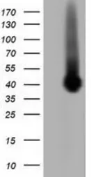 Anti-Pleckstrin antibody [4G6] used in Western Blot (WB). GTX83874