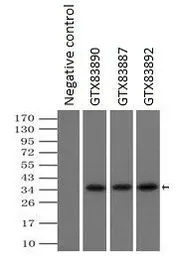 Anti-PIM2 antibody [9A5] used in Immunoprecipitation (IP). GTX83892