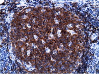 Anti-PIK3AP1 antibody [7A11] used in IHC (Paraffin sections) (IHC-P). GTX83893