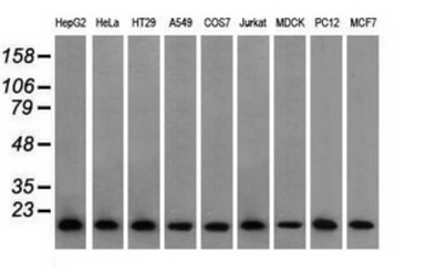 Anti-Profilin 1 antibody [1D5] used in Western Blot (WB). GTX83903