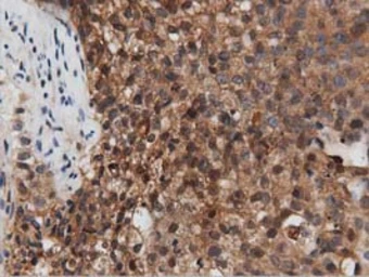 Anti-PEPD antibody [1B7] used in IHC (Paraffin sections) (IHC-P). GTX83909