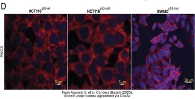 Anti-PAICS antibody [2C9] used in Immunocytochemistry/ Immunofluorescence (ICC/IF). GTX83950