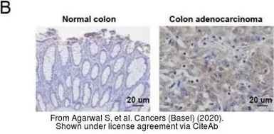 Anti-PAICS antibody [2C9] used in IHC (Paraffin sections) (IHC-P). GTX83950