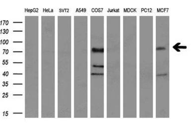 Anti-TrkC antibody [4E10] used in Western Blot (WB). GTX83977