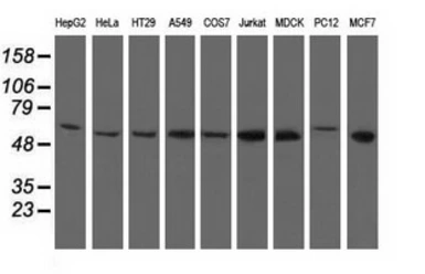 Anti-NT5DC1 antibody [1E11] used in Western Blot (WB). GTX83992