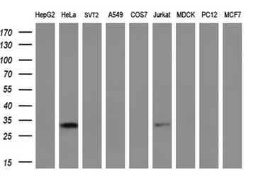 Anti-NSE2 antibody [4H9] used in Western Blot (WB). GTX83996