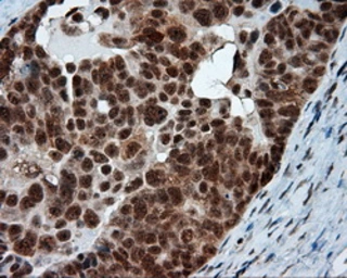 Anti-NPR-C antibody [4C3] used in IHC (Paraffin sections) (IHC-P). GTX84010