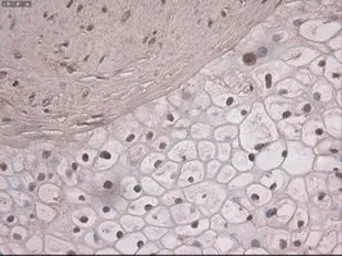 Anti-NOTCH1 antibody [4C9] used in IHC (Paraffin sections) (IHC-P). GTX84020