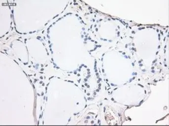 Anti-Noggin antibody [1C1] used in IHC (Paraffin sections) (IHC-P). GTX84021