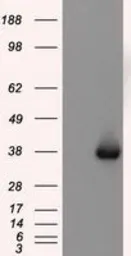 Anti-NIT2 antibody [6H7] used in Western Blot (WB). GTX84040