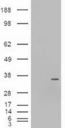 Anti-NGN3 antibody [5A8] used in Western Blot (WB). GTX84045