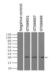 Anti-Neurogenin 1 antibody [8G8] used in Immunoprecipitation (IP). GTX84047