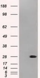 Anti-Neurogenin 1 antibody [8G8] used in Western Blot (WB). GTX84047