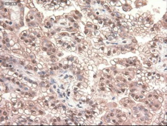 Anti-c-Myc antibody [3F2] used in IHC (Paraffin sections) (IHC-P). GTX84065