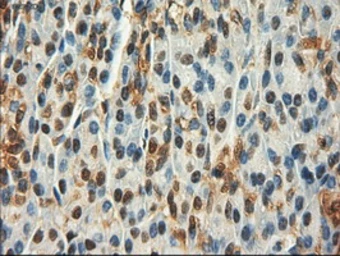 Anti-c-Myc antibody [3F2] used in IHC (Paraffin sections) (IHC-P). GTX84065